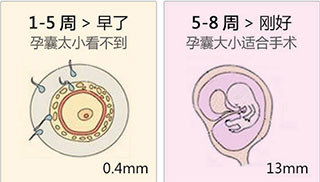 杭州女性孕囊多大适合做人流？